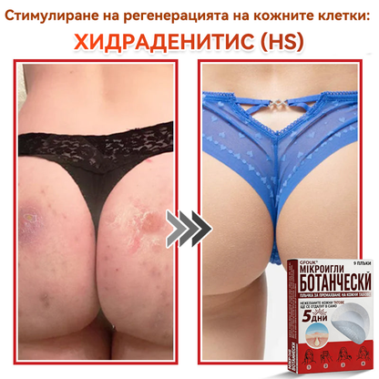 🎁 Остават само 5 опаковки! Сега можете да получите допълнителна ОТСТЪПКА от 50%!🗽✅ GFOUK® Ботаничен пластир с микроигли за премахване на кожни образувания
