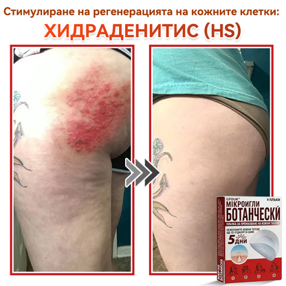 🔥 GFOUK® Ботаничен пластир с микроигли за премахване на кожни образувания