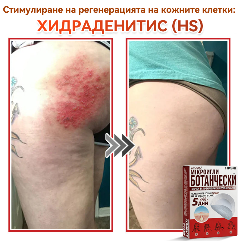 🌍GFOUK® Ботаничен пластир с микроигли за премахване на кожни образувания