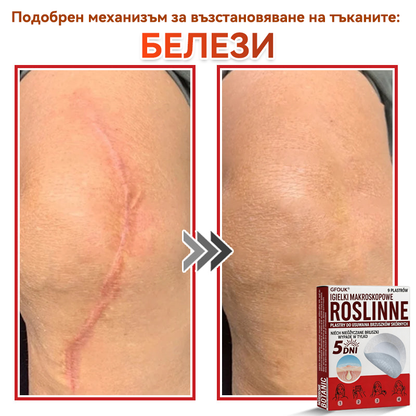 🌍GFOUK® Ботаничен пластир с микроигли за премахване на кожни образувания