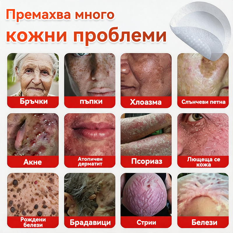 🎁 Остават само 5 опаковки! Сега можете да получите допълнителна ОТСТЪПКА от 50%!🗽✅ GFOUK® Ботаничен пластир с микроигли за премахване на кожни образувания