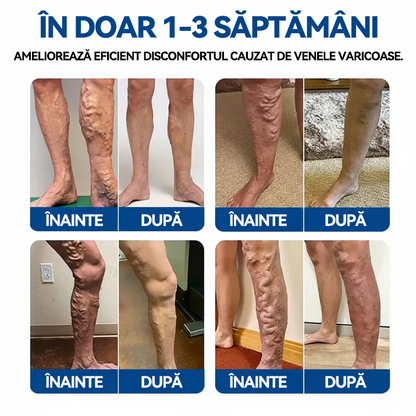 🏆🏆🇧🇬👨‍⚕️✅ TAILEDEN® VeinEase Микроиглени пластири за терапия ⚡ Незабавно облекчение, дълготрайни резултати