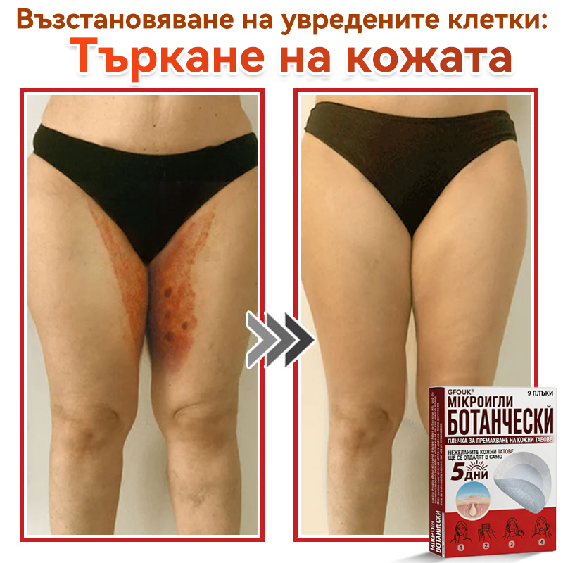🔥 GFOUK® Ботаничен пластир с микроигли за премахване на кожни образувания