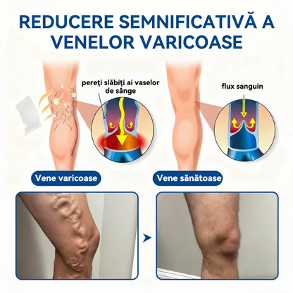 🏆🏆🇧🇬👨‍⚕️✅ TAILEDEN® VeinEase Микроиглени пластири за терапия ⚡ Незабавно облекчение, дълготрайни резултати