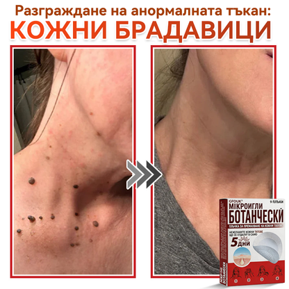 🎁 Остават само 5 опаковки! Сега можете да получите допълнителна ОТСТЪПКА от 50%!🗽✅ GFOUK® Ботаничен пластир с микроигли за премахване на кожни образувания