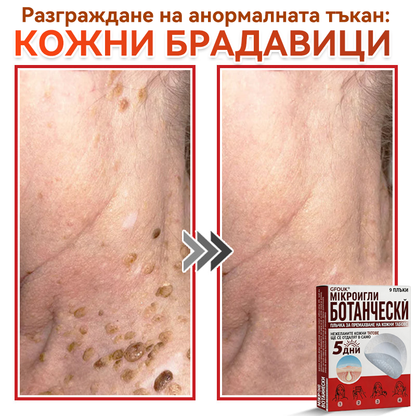 🔥 GFOUK® Ботаничен пластир с микроигли за премахване на кожни образувания