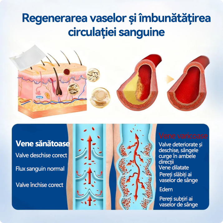 🏆🏆🇧🇬👨‍⚕️✅ TAILEDEN® VeinEase Микроиглени пластири за терапия ⚡ Незабавно облекчение, дълготрайни резултати