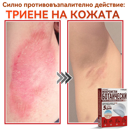 🎁 Остават само 5 опаковки! Сега можете да получите допълнителна ОТСТЪПКА от 50%!🗽✅ GFOUK® Ботаничен пластир с микроигли за премахване на кожни образувания