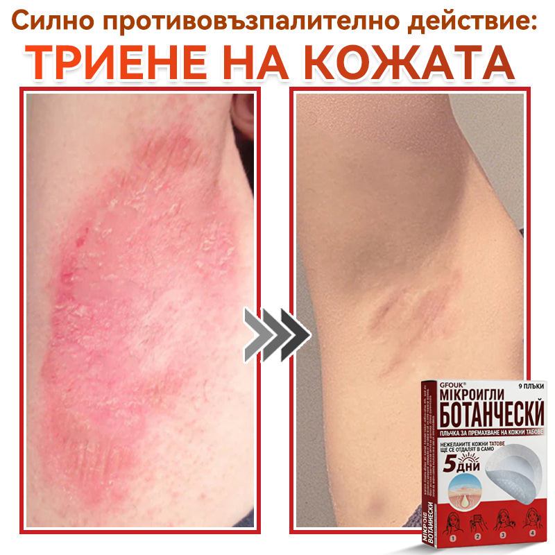 🔥🔥GFOUK® Ботаничен пластир с микроигли за премахване на кожни образувания